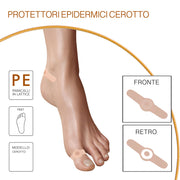 Paracalli a Cerotto